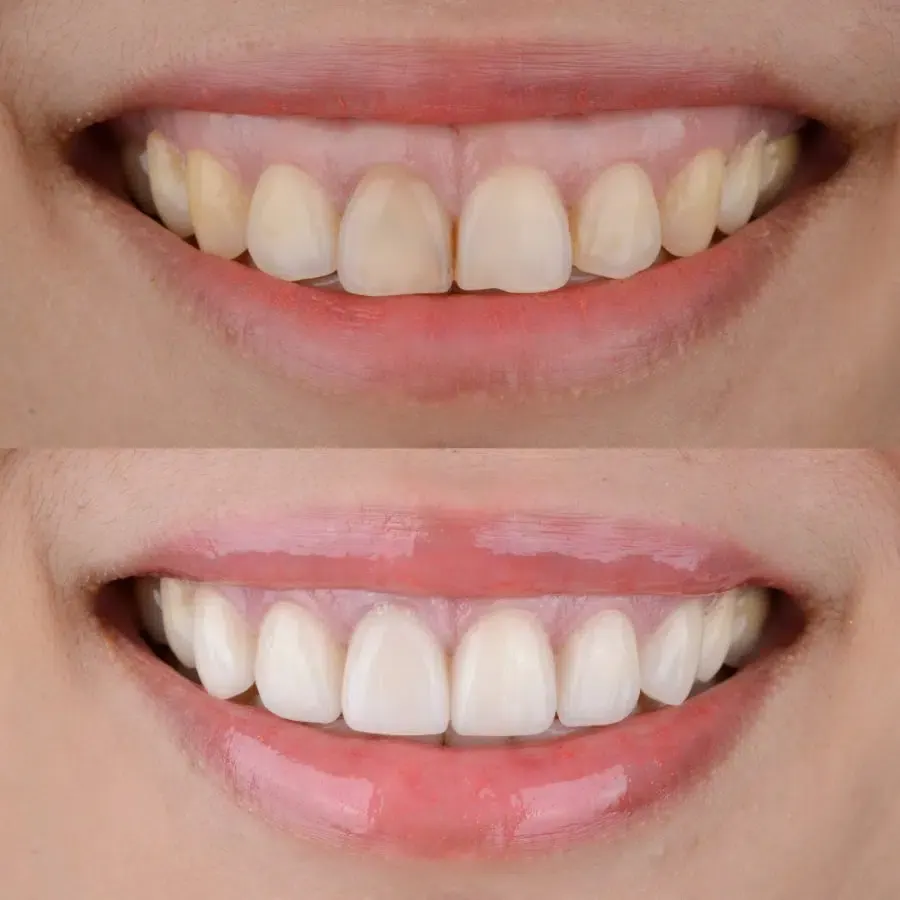 Cosmetic smile transformation and aesthetic dentistry